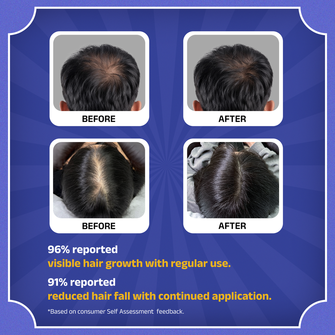 Rockstar Blue Pea Hair Growth Serum