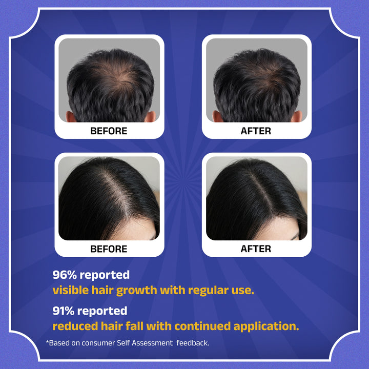 Rockstar Advanced Hair Growth Serum