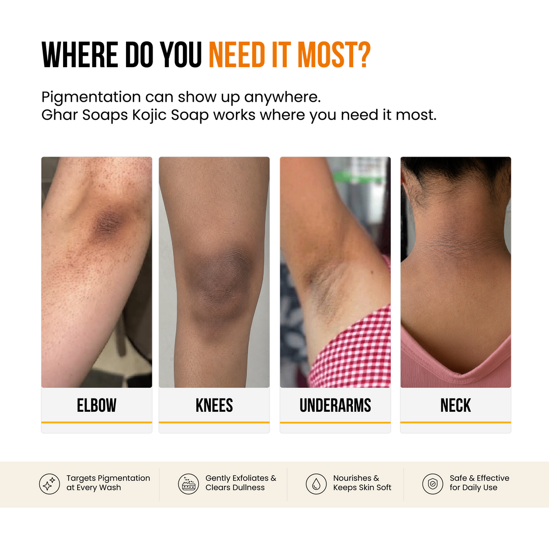 Kojic Acid Soap for De-Pigmentation & Dark Spot Reduction